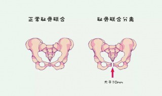 耻骨在哪个位置（耻骨在哪个位置示意图）