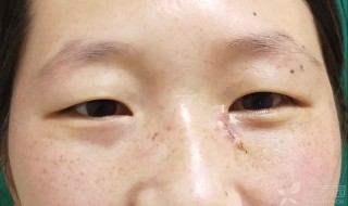 眼角有痣代表什么（男人左眼角有痣代表什么）