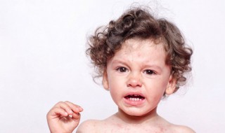 孩子头上长虱子怎么办（孩子头上长虱子怎么办怎样简便消除）