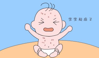宝宝长痱子用什么擦好（宝宝长痱子用什么擦好得快）