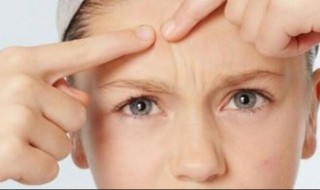 长痘的原因都有些什么（长痘的原因都有哪些）