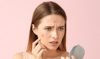 痘痘要怎么处理（痘痘要怎么处理掉它的嘌呤呢）