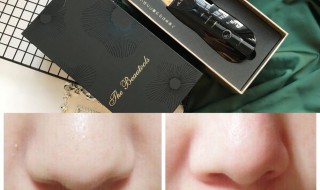 黑头一直不挤会怎样 黑头粉刺怎么样才能彻底根除