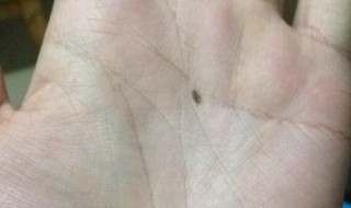 掌心有痣代表什么 女人左手掌心有痣代表什么