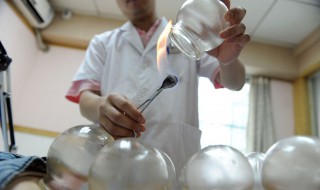 拔罐出水泡怎么回事（自己在家拔罐出水泡怎么回事）