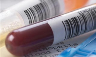 血液制品是指什么（血液制品是指什么药）