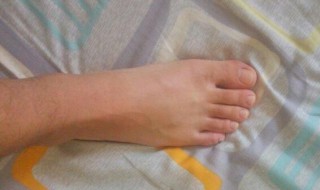 希腊脚的女人代表什么（希腊脚的女人代表什么命运）