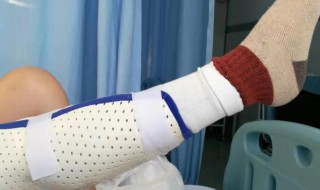 骨折能吃鸡蛋吗（压缩性骨折能吃鸡蛋吗）