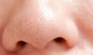 黑头是怎样产生的 身体上的黑头是怎样产生的