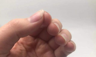 手指甲没有月牙正常吗（有的人手指甲没有月牙正常吗）