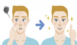 脸上闷痘怎么处理（脸闷痘怎么办）