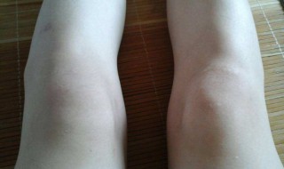 让膝盖变瘦的方法（如何让膝盖变瘦）