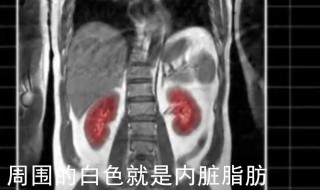 怎么知道是不是内脏脂肪多
