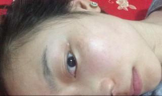 斑怎样才能清除（斑怎么样去除）
