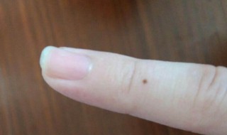苍蝇屎在脸上怎么去掉（苍蝇屎在脸上怎么去掉图片）